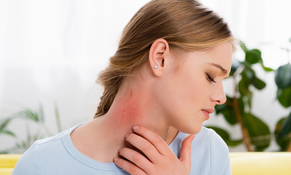 Recognizing and Treating Allergic Reactions