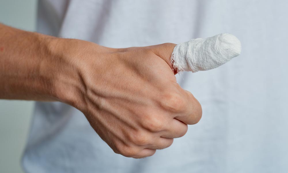 Painless Ingrown or Hangnail Removal